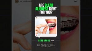 Should You Get Invisalign?